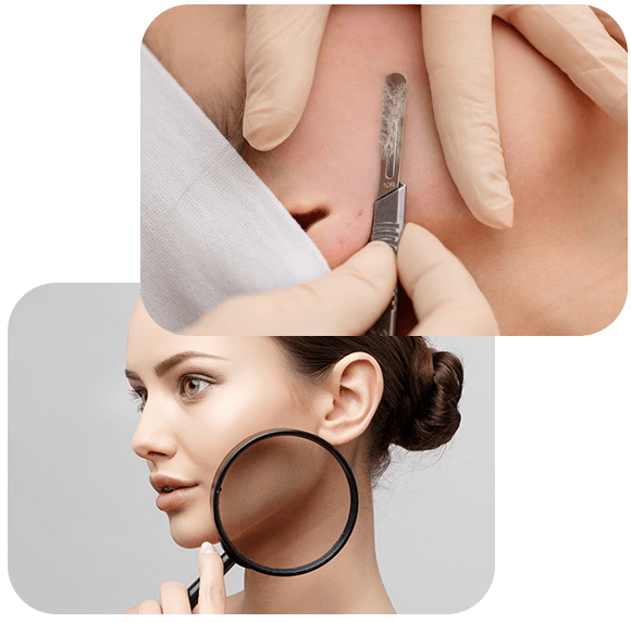 Procedimento de Dermaplaning
